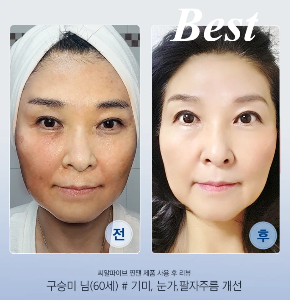 피부 탄력 개선을 설명하는 이미지